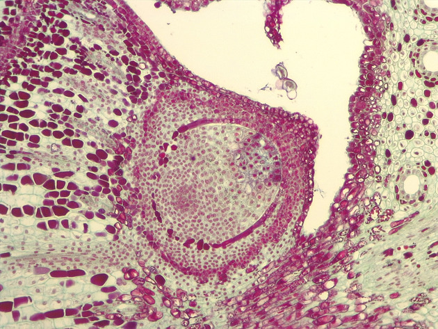 Female Pine Ovule Slides - Female Pine Ovule 02 200X